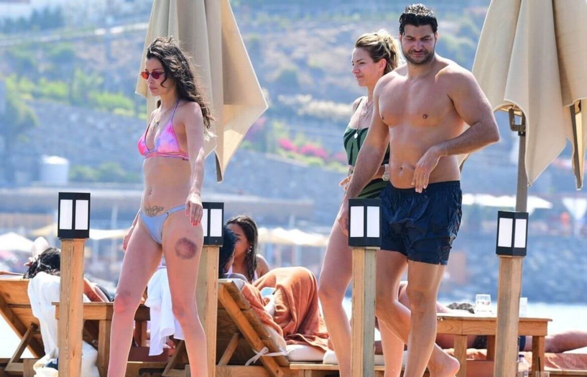 Müjde Uzman Bodrum Tatilinde Objektiflere Takıldı: Bacağındaki Morluk Dikkat Çekti
