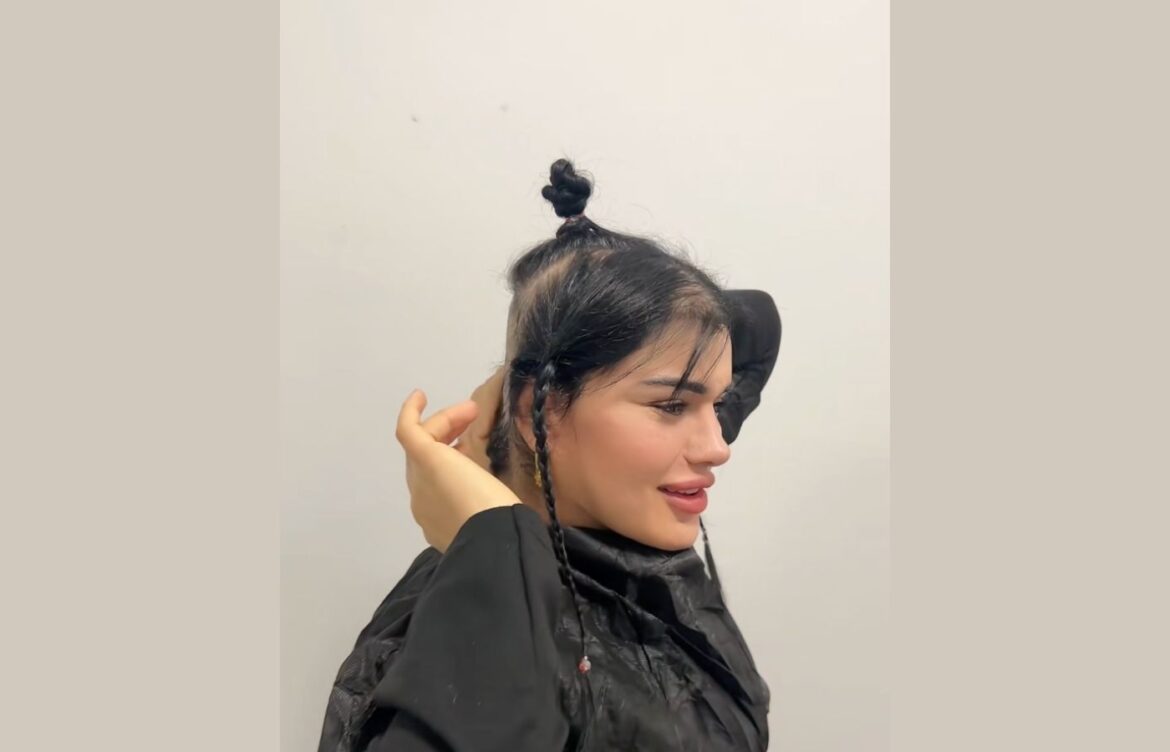 TikTok Fenomeni Hülya Mizgin’in Saçları Estetik Kurbanı!